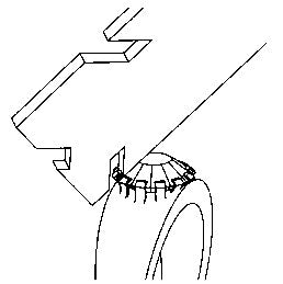 Prong Lifter - 7 different notches for removing precious stones